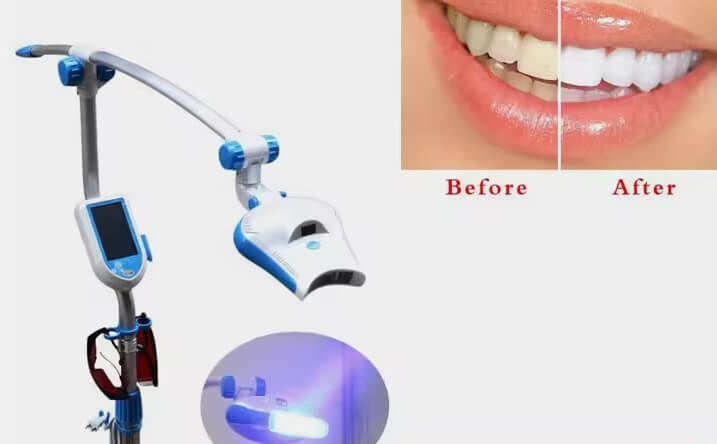 Professional LED teeth whitening machine with adjustable arm and control screen, shown alongside a before-and-after image of a woman's brightened smile after whitening treatment