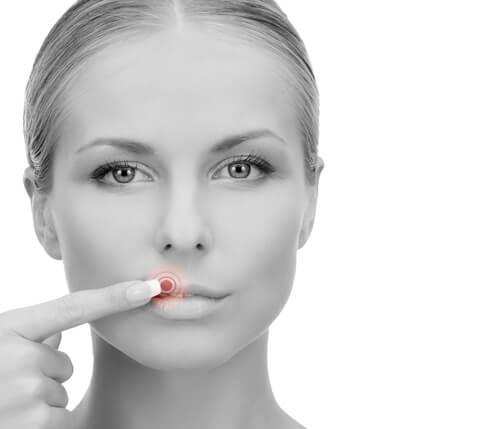 cold sore red light therapy