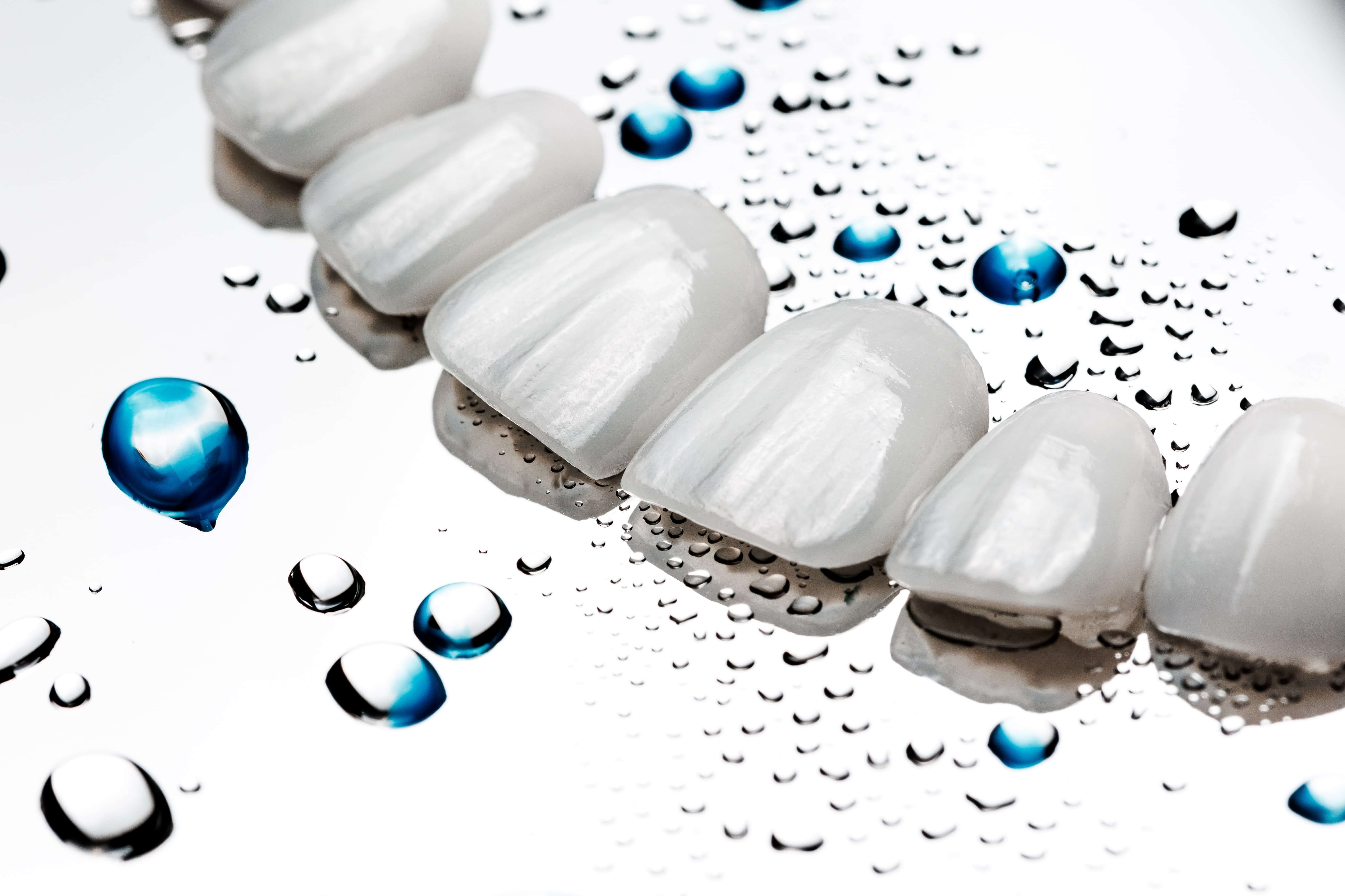 Dental professional performing a 20-minute LaserGlow teeth-whitening touch-up to remove stains between porcelain veneers and restore a bright, even smile.