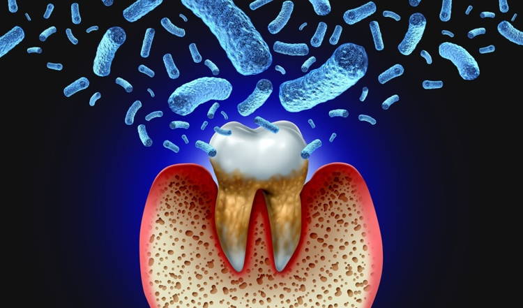 LaserGlow Hyaluronic Acid Mouthwash offers superior hydration and gentle care for healthier gums and fresh breath.