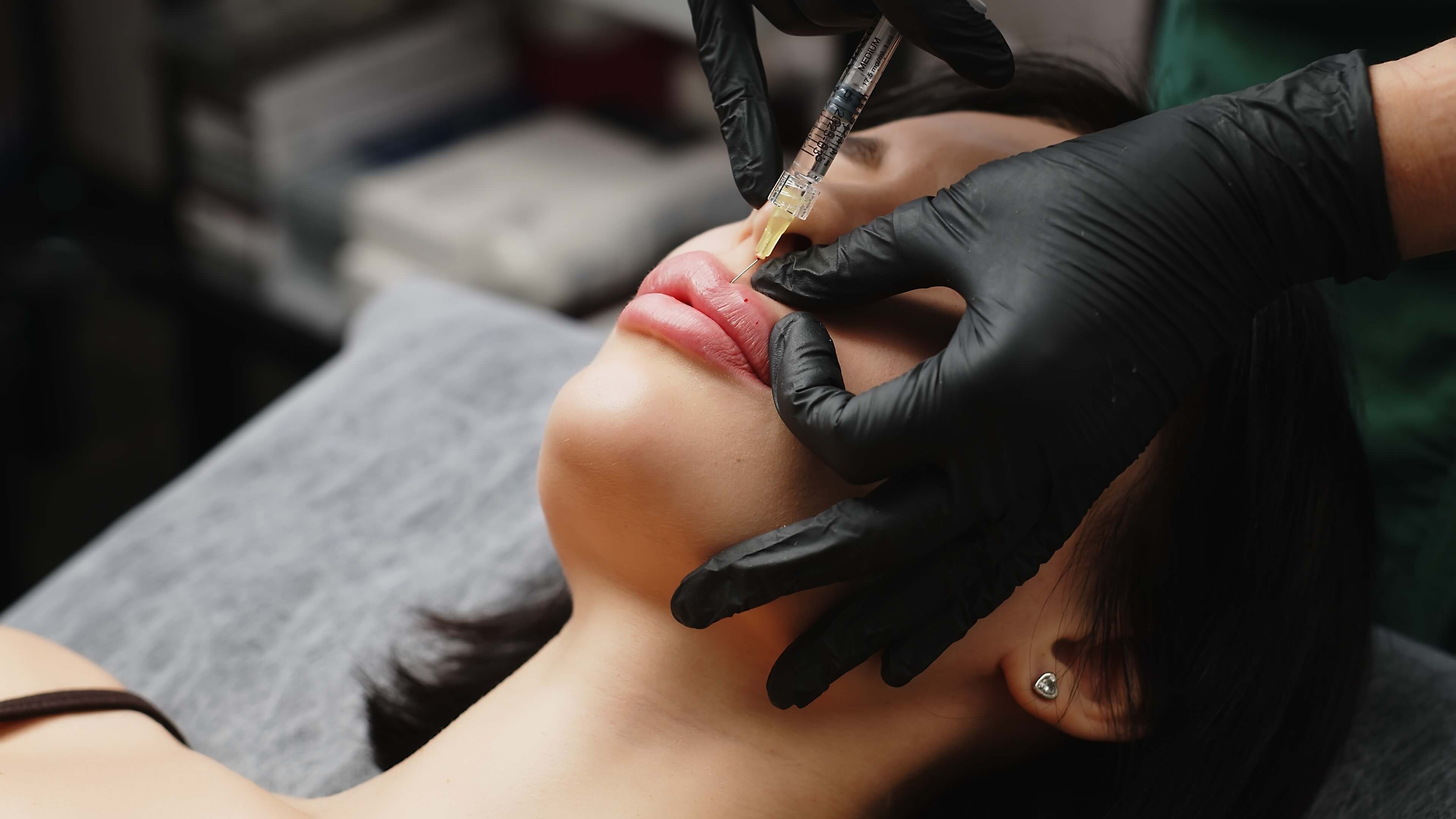 Lip filler injection procedure with LaserGlow Polypeptide Lip Repair Oil recommended for post-filler aftercare to reduce swelling and enhance hydration