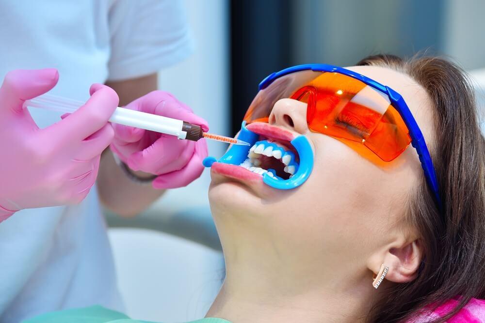 The Science of a Perfect Smile How Laser Teeth Whitening Works LaserGlow