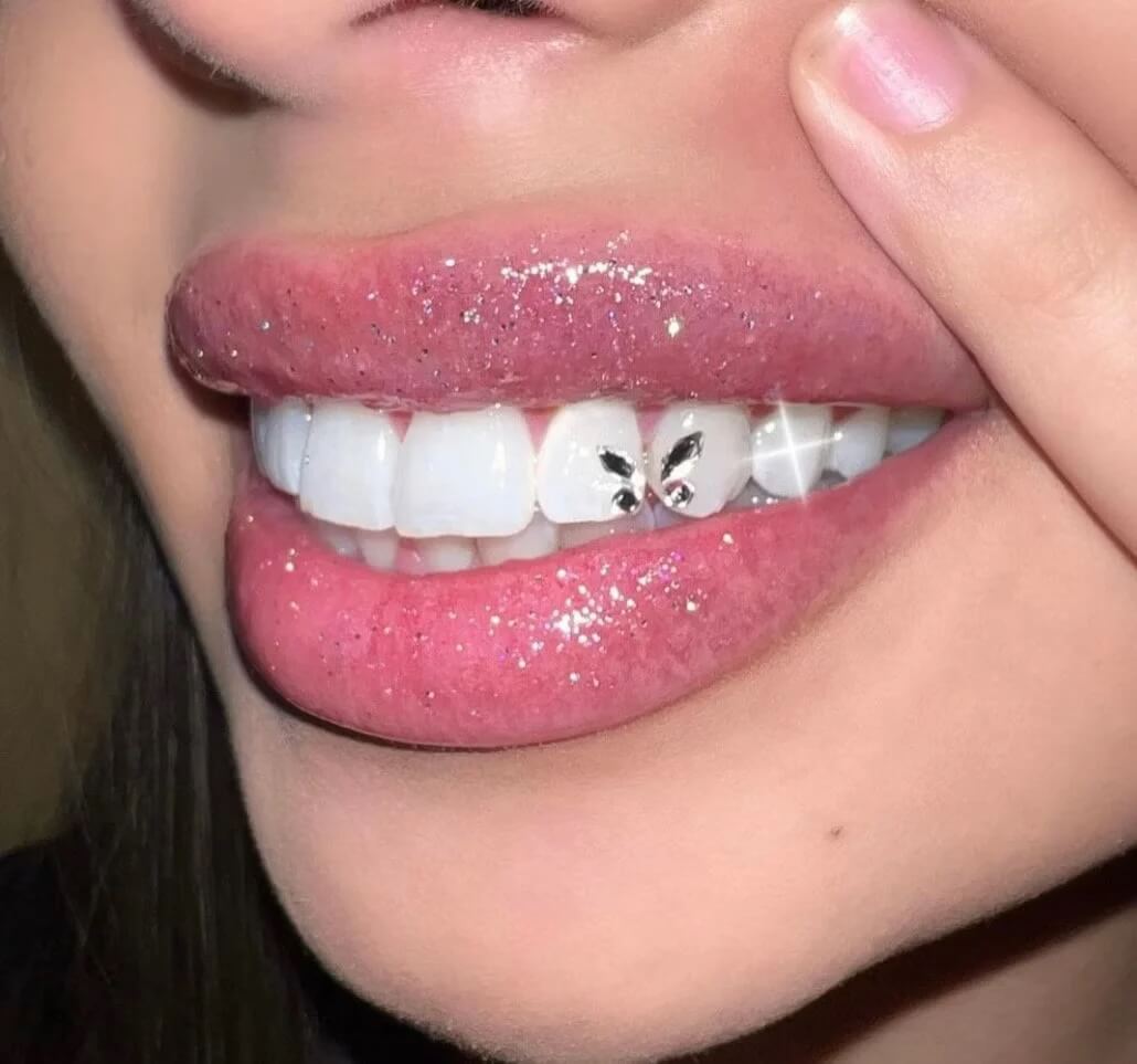 how long do tooth gems last