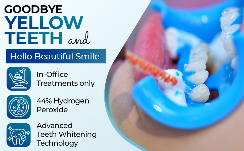 A professional-grade syringe of LaserGlow teeth whitening gel targeting tough teeth stains and discoloration.