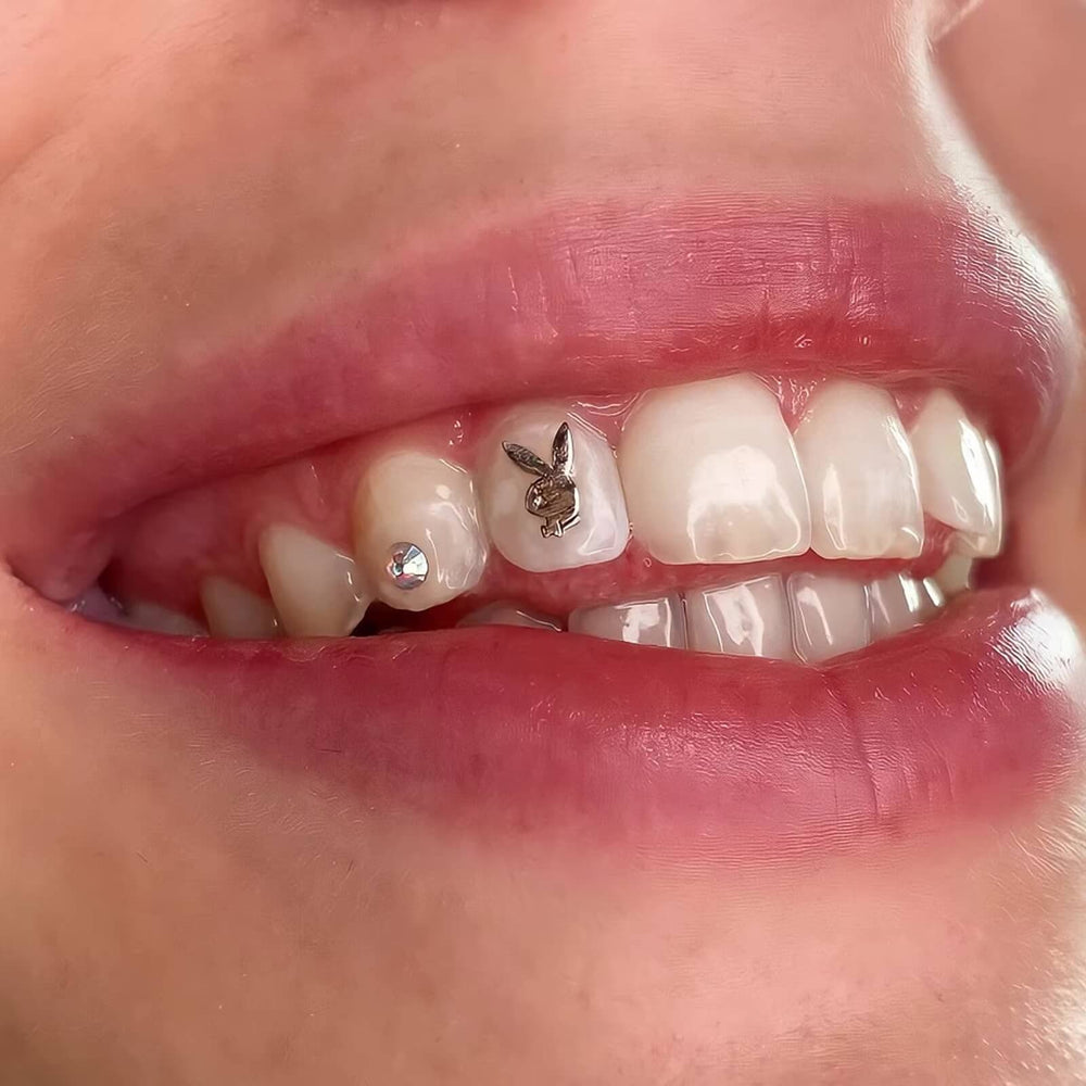 Close-up of an 18 K gold LaserGlow bunny-shaped tooth gem in a Playboy-inspired silhouette.