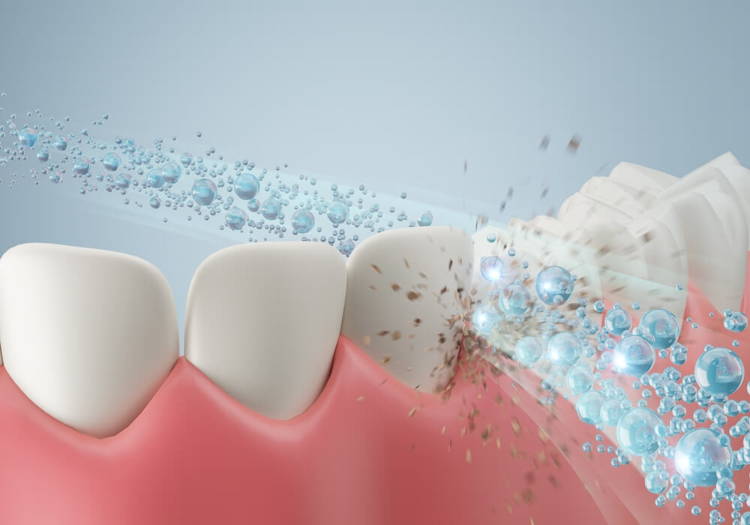LaserGlow Hyaluronic Acid Mouthwash combines advanced hydration with gum protection for lasting oral freshness.
