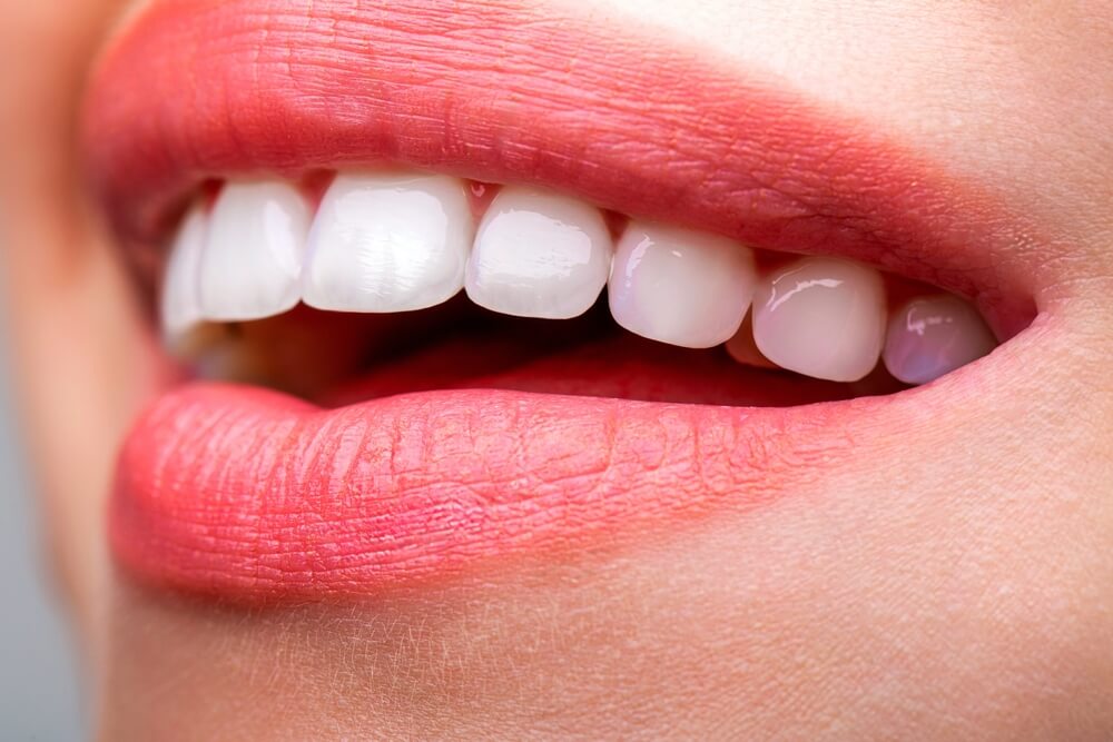 LaserGlow Tooth Gloss provides the perfect glossy touch for bright, glowing smiles that shine