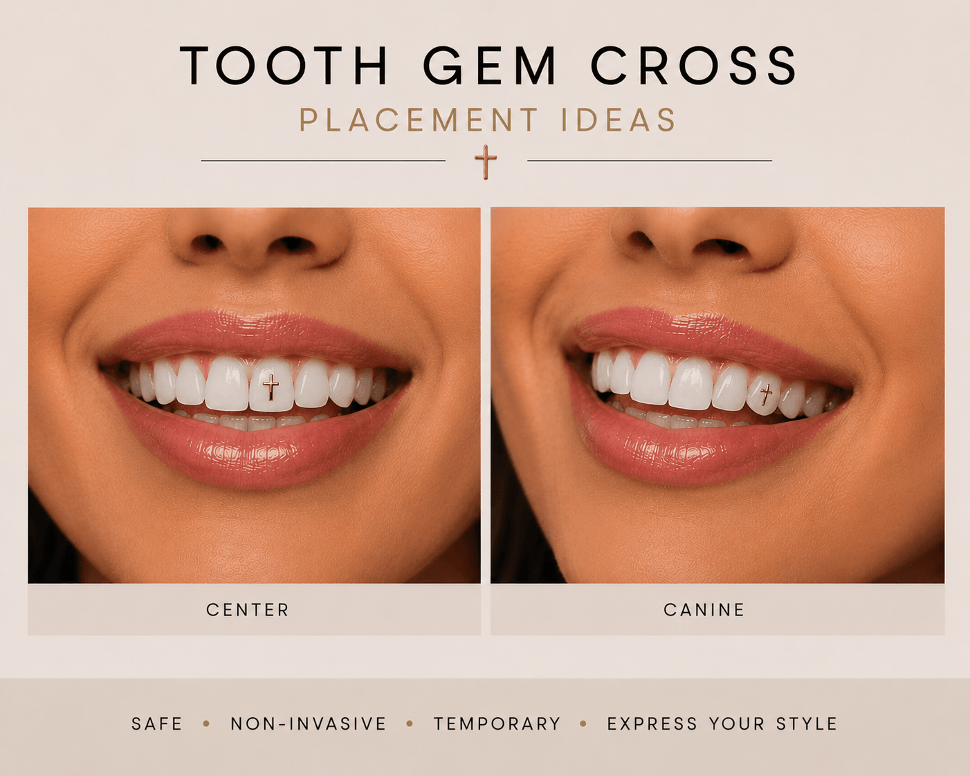 Cross tooth gem placement ideas showing center and canine placement on front teeth