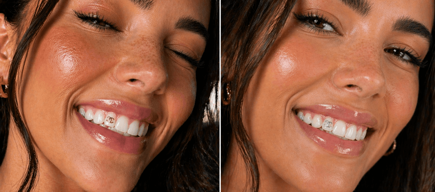 Close-up smile with gold and silver tooth gems