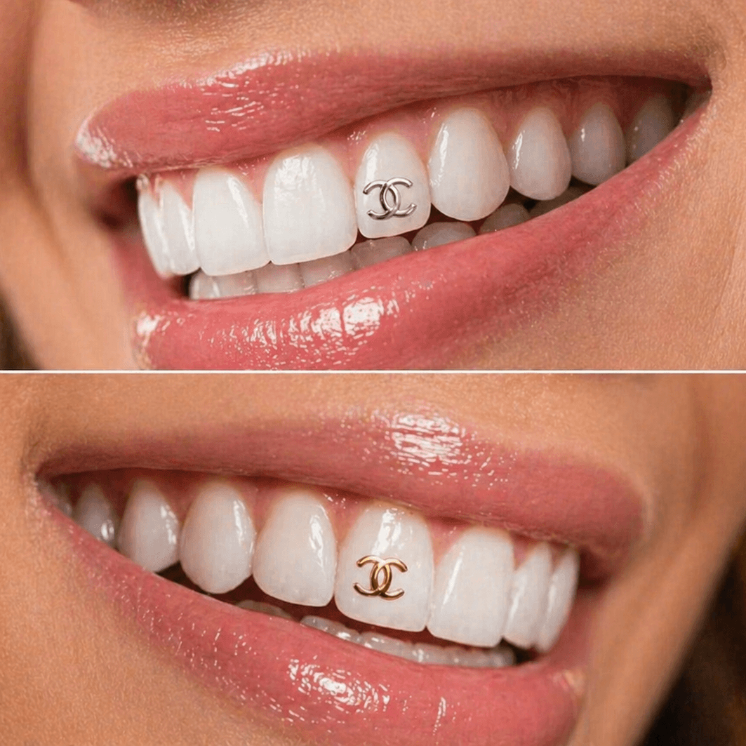 Gold designer-inspired tooth gems in clear display case