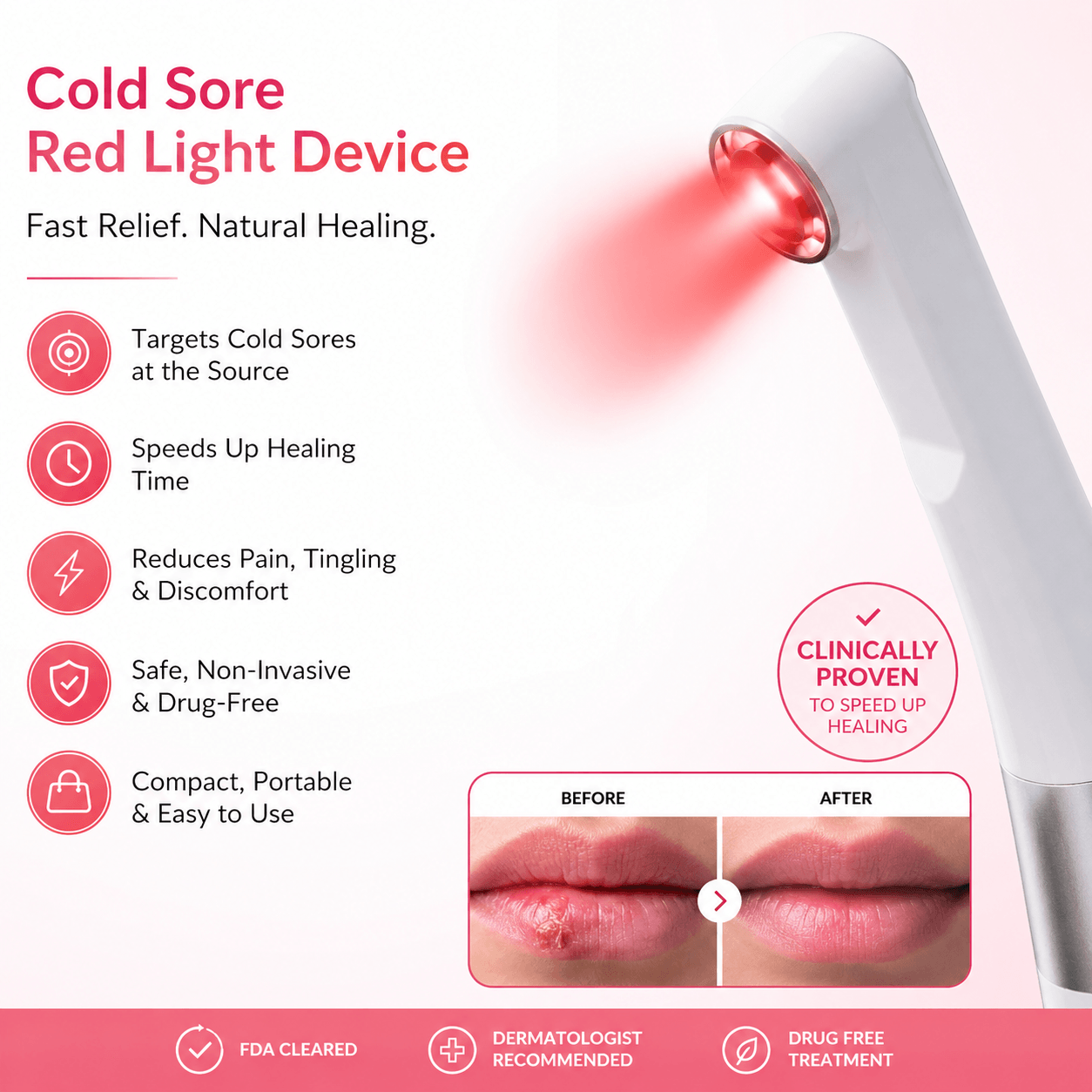 LaserGlow cold sore red light therapy device for targeted lip treatment, fast relief, drug-free healing support, and portable at-home use