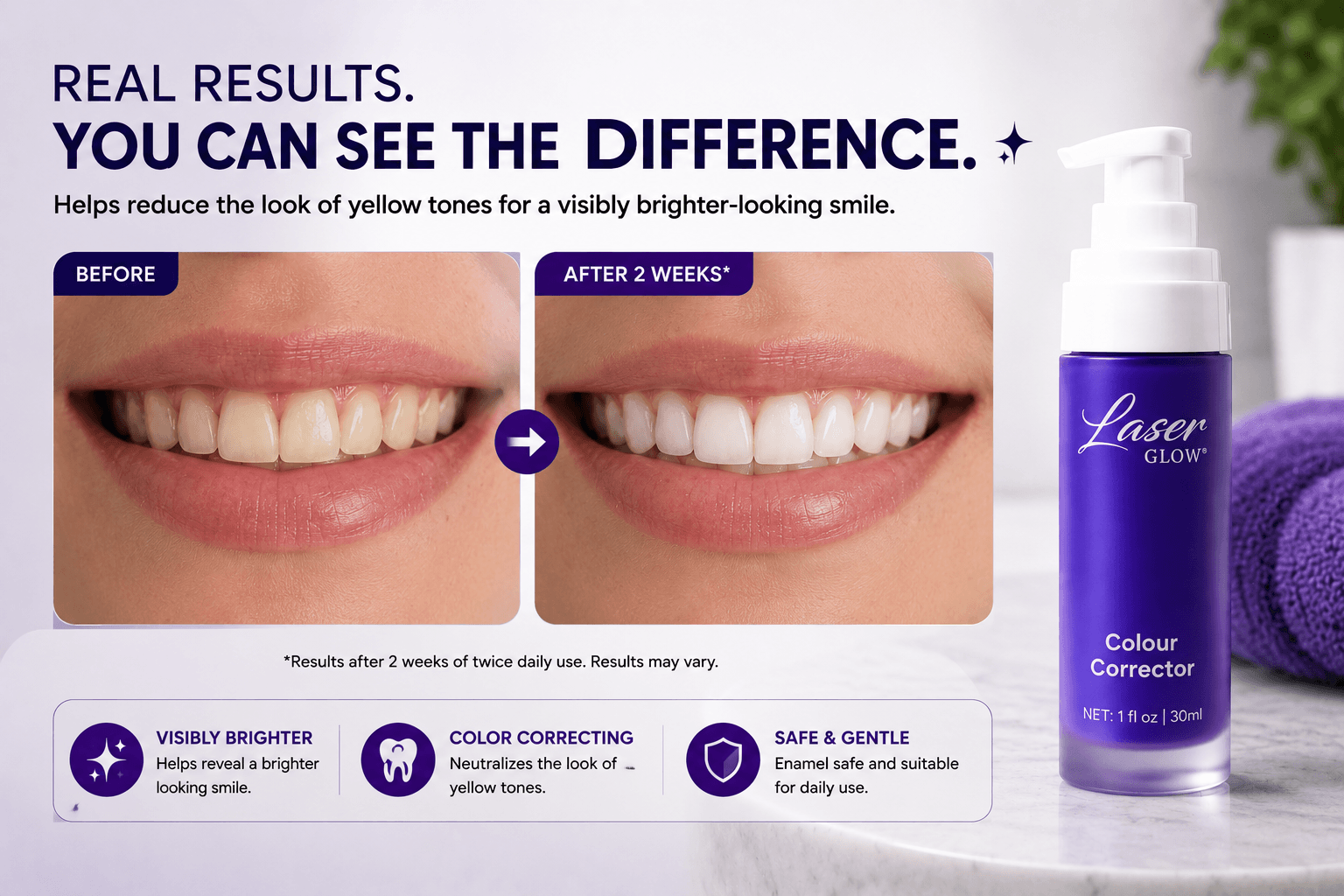 LaserGlow Purple Toothpaste realistic before and after result showing reduced yellow tones and a brighter looking smile