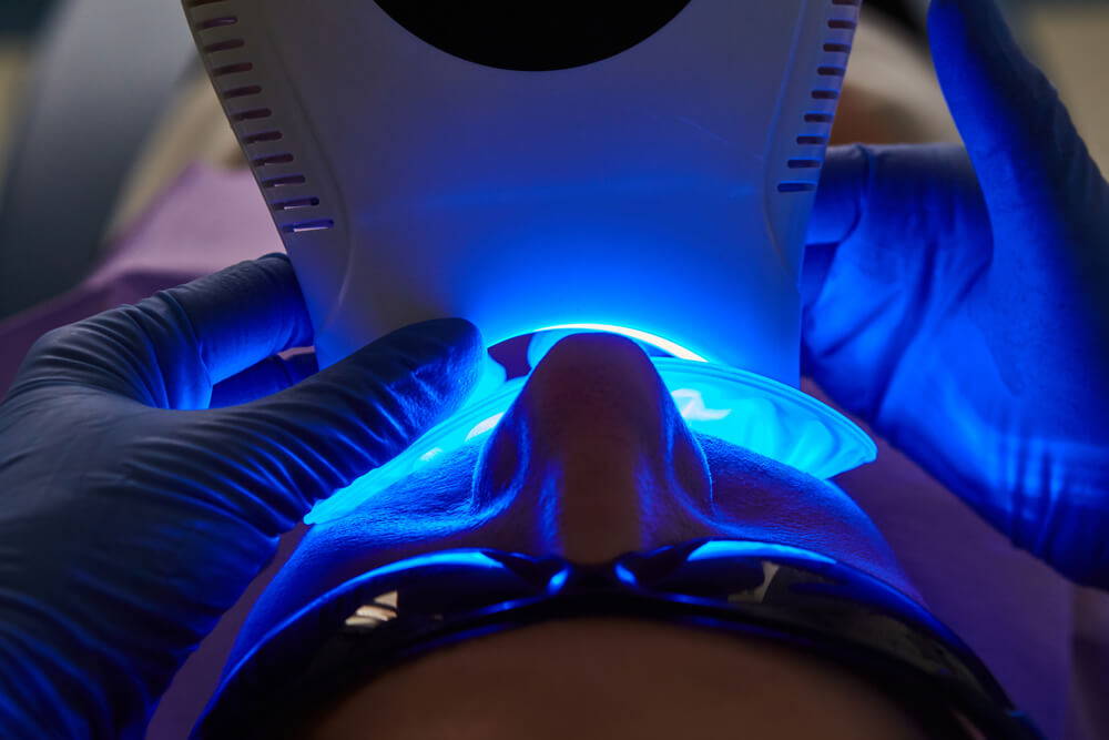 LaserGlow teeth whitening laser machines offering advanced technology for safe, effective, and professional-grade teeth whitening treatments.