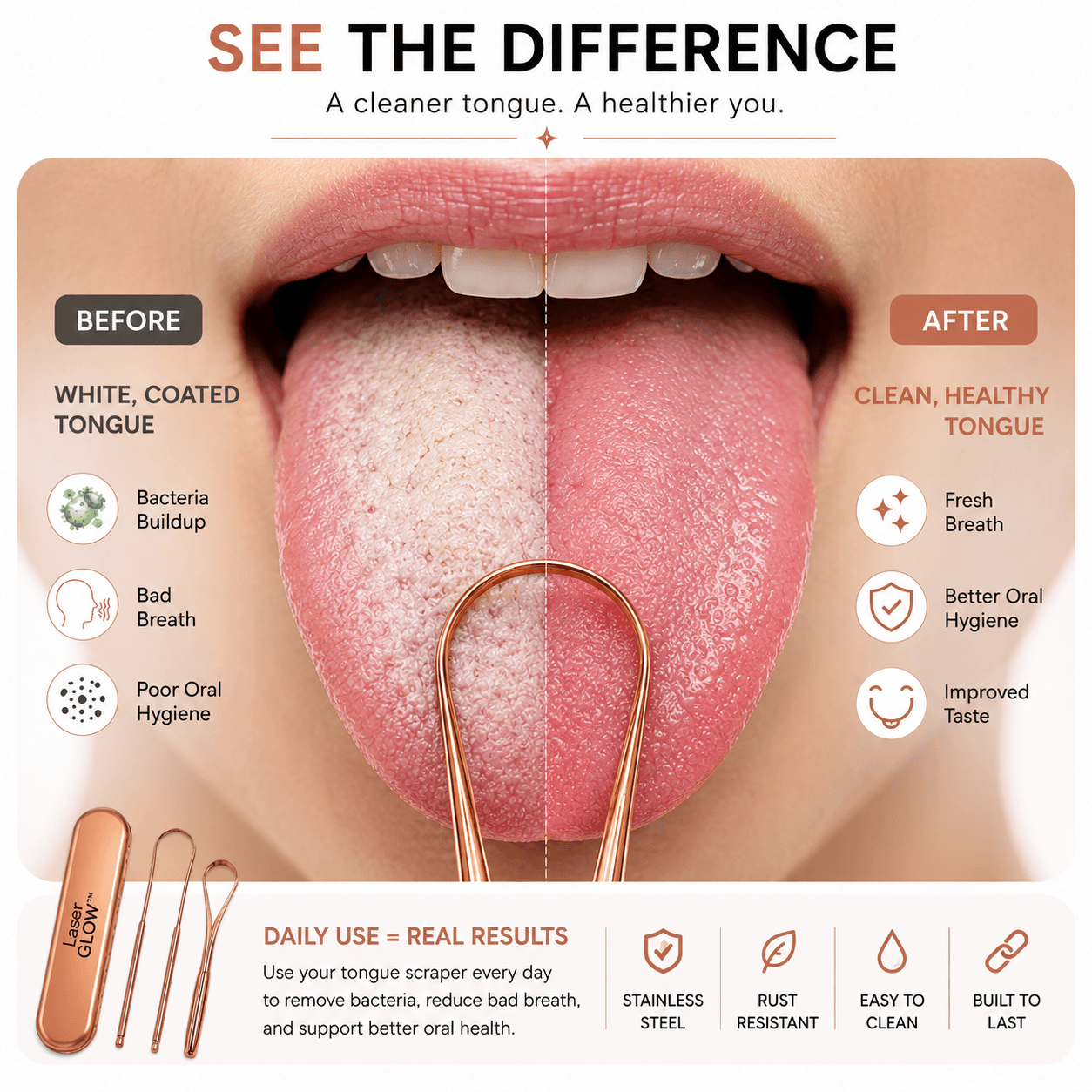 Realistic before and after tongue scraper comparison showing white coated tongue and clean healthy tongue with LaserGlow rose gold tongue scraper set