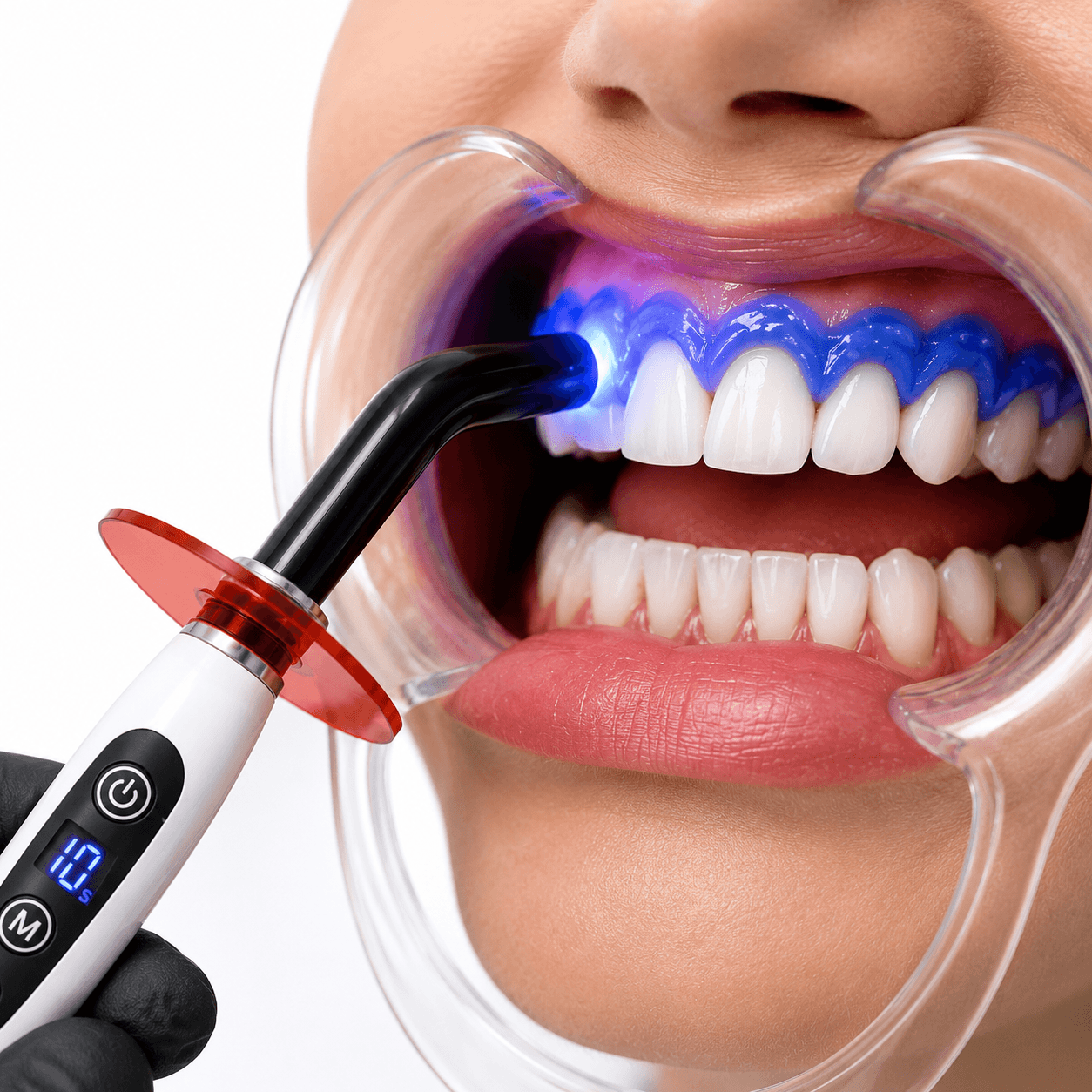 Professional LED curing light curing blue gingival barrier gel during teeth whitening treatment