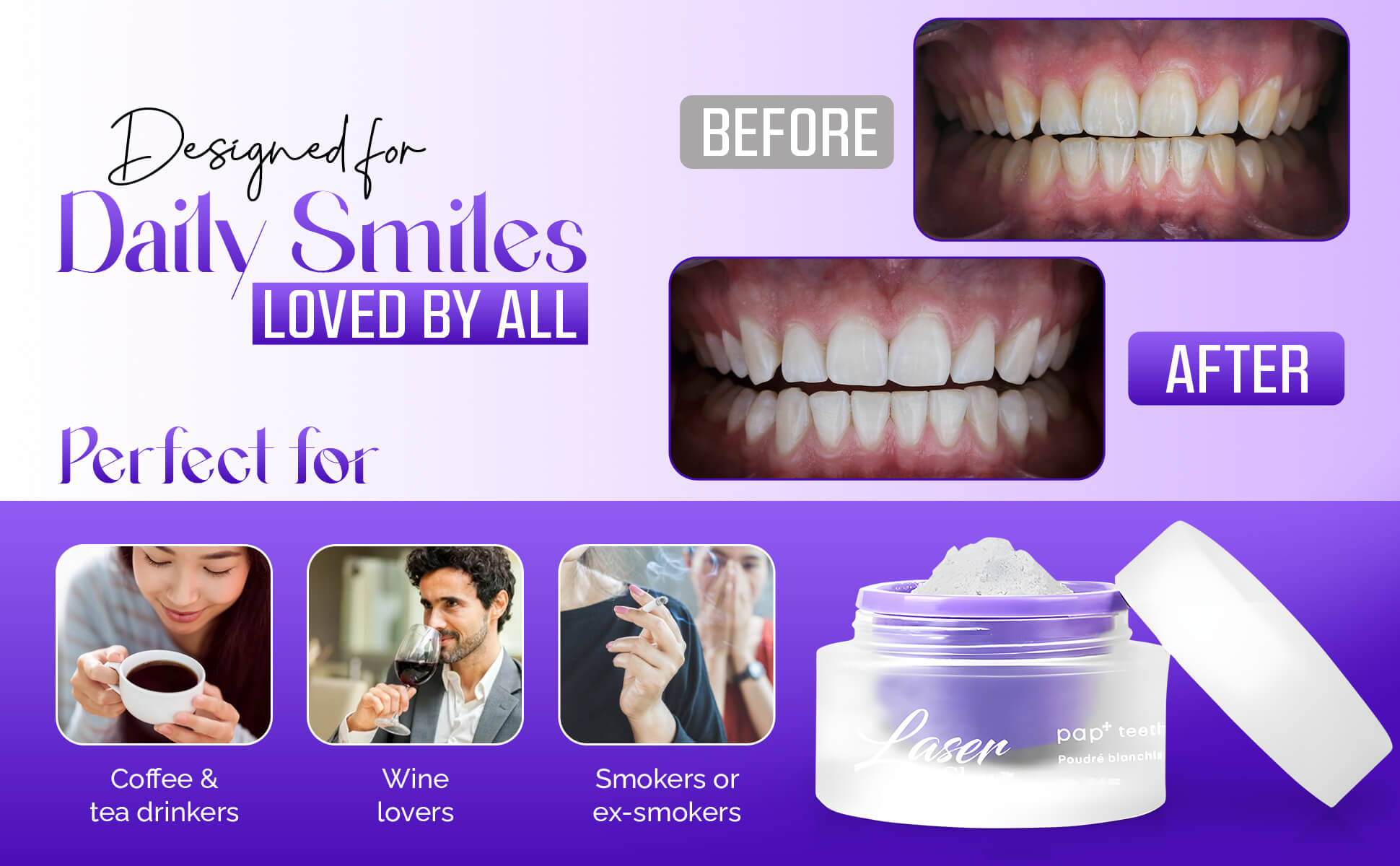Before and after results using LaserGlow PAP+ powder – peroxide-free teeth whitening for daily use.