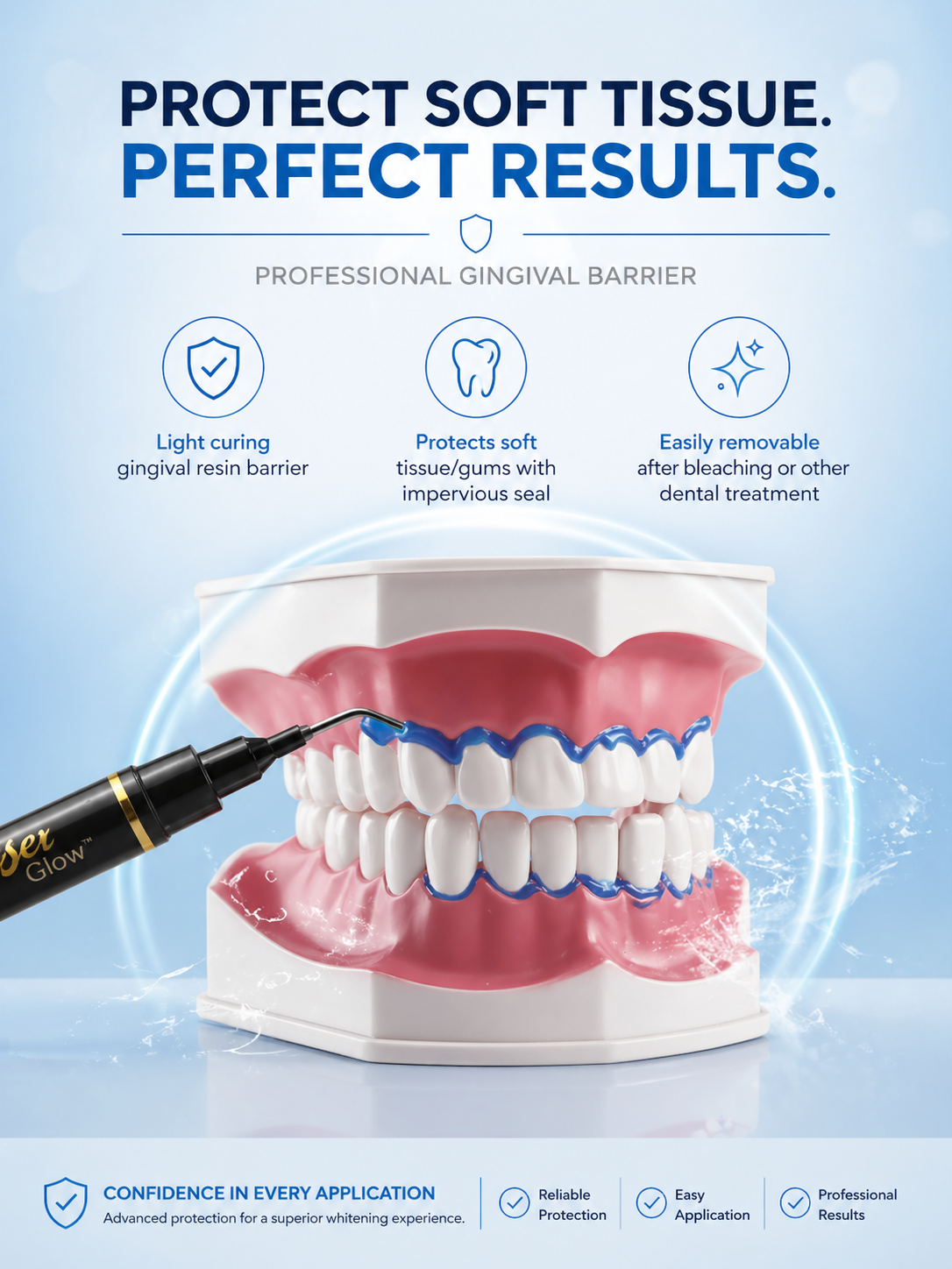 Professional gingival barrier applied to dental model for soft tissue protection during teeth whitening treatment